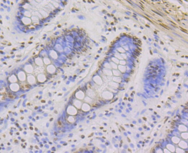 ILF3 Antibody in Immunohistochemistry (Paraffin) (IHC (P))