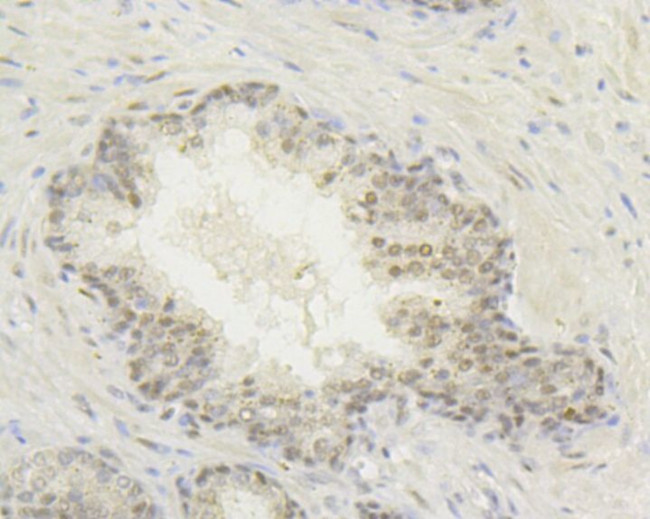 HIF1AN Antibody in Immunohistochemistry (Paraffin) (IHC (P))