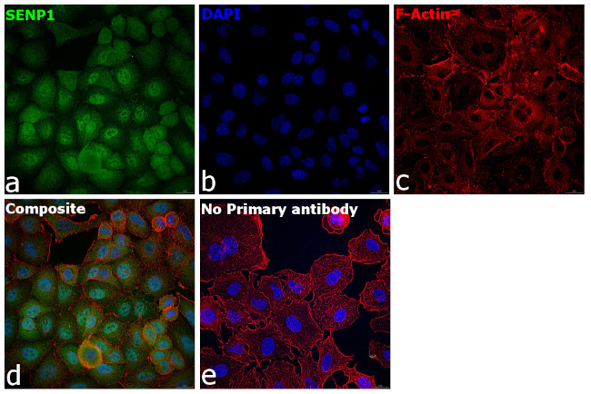 SENP1 Antibody in Immunocytochemistry (ICC/IF)