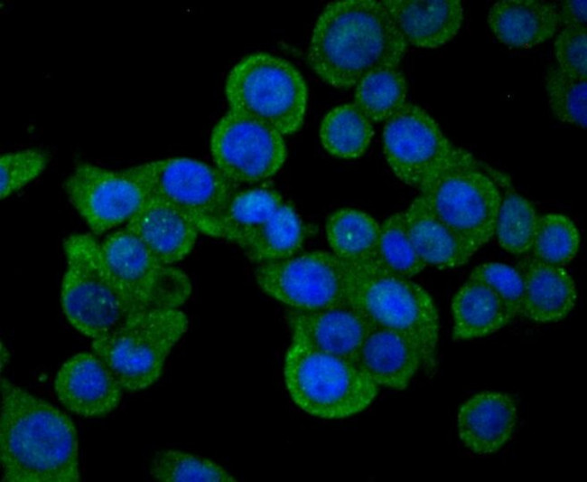 SENP1 Antibody in Immunocytochemistry (ICC/IF)