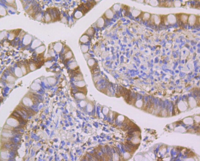 SENP1 Antibody in Immunohistochemistry (Paraffin) (IHC (P))