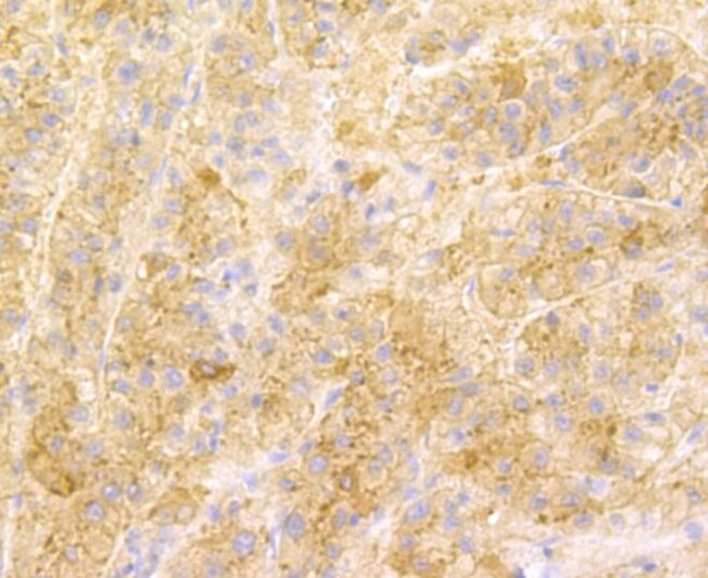 SENP1 Antibody in Immunohistochemistry (Paraffin) (IHC (P))