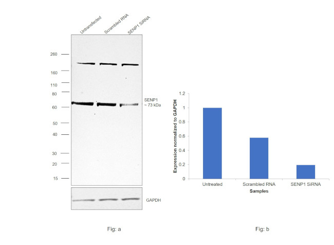 SENP1 Antibody in Western Blot (WB)