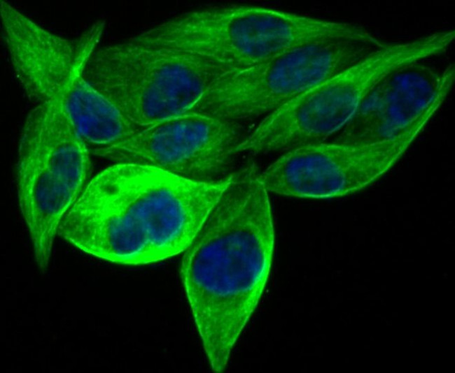 BAP31 Antibody in Immunocytochemistry (ICC/IF)