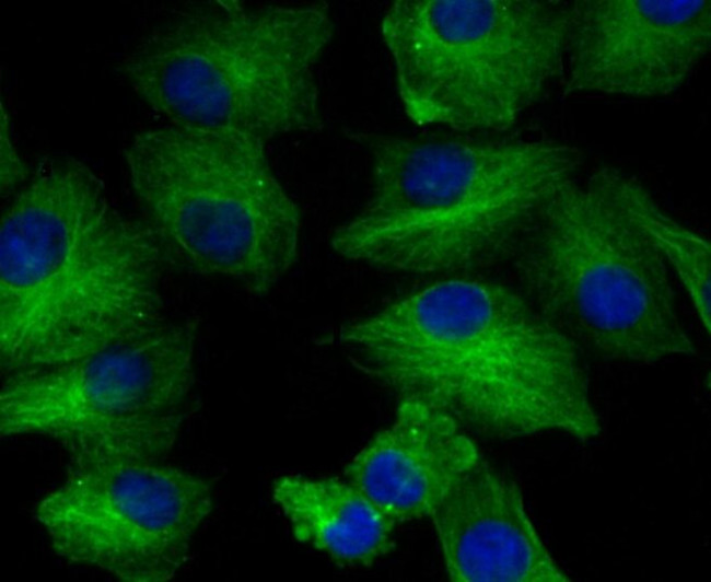 BAP31 Antibody in Immunocytochemistry (ICC/IF)