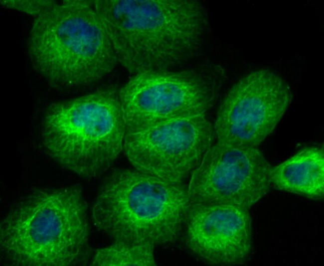 BAP31 Antibody in Immunocytochemistry (ICC/IF)