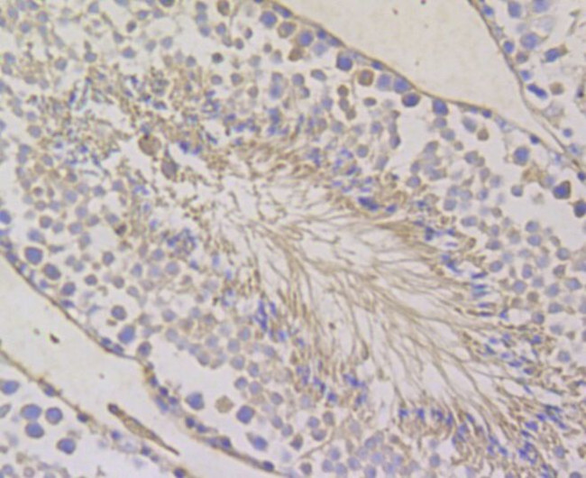 BAP31 Antibody in Immunohistochemistry (Paraffin) (IHC (P))