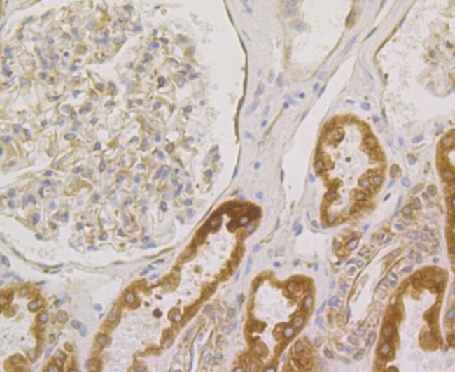 BAP31 Antibody in Immunohistochemistry (Paraffin) (IHC (P))