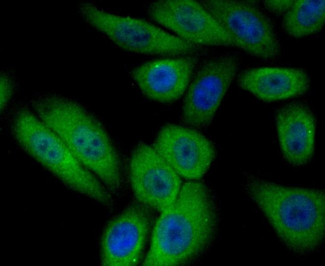 PIST Antibody in Immunocytochemistry (ICC/IF)