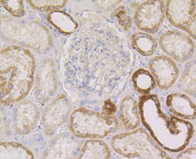 PIST Antibody in Immunohistochemistry (Paraffin) (IHC (P))