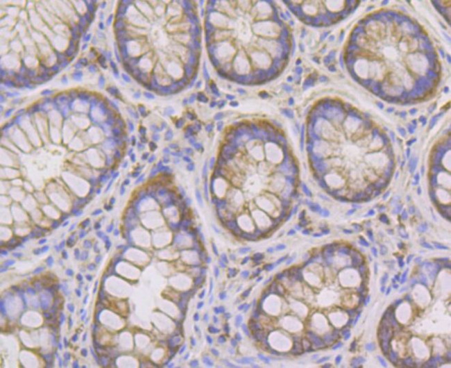 PIST Antibody in Immunohistochemistry (Paraffin) (IHC (P))