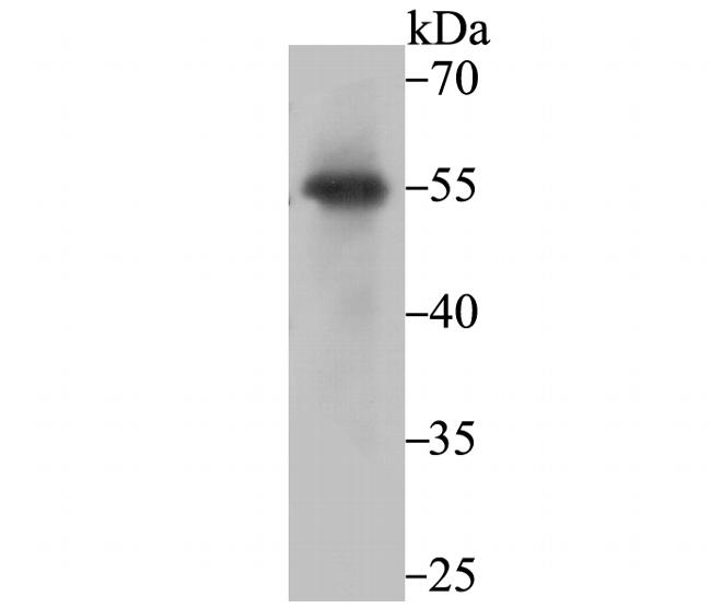 PIST Antibody in Western Blot (WB)