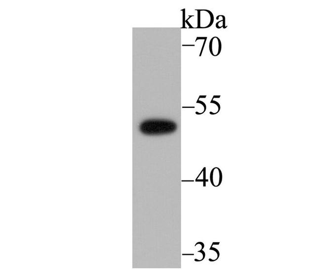 PICK1 Antibody in Western Blot (WB)