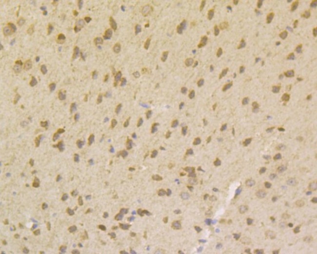 SMN1 Antibody in Immunohistochemistry (Paraffin) (IHC (P))