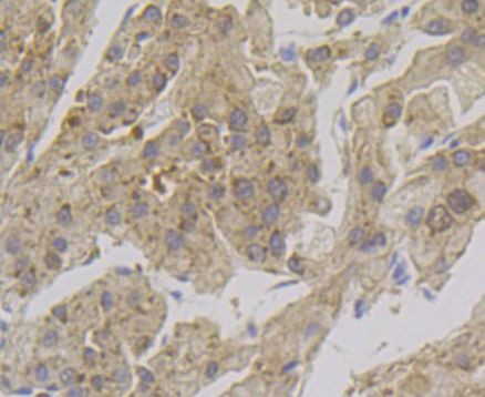 Alcohol Dehydrogenase 1A Antibody in Immunohistochemistry (Paraffin) (IHC (P))