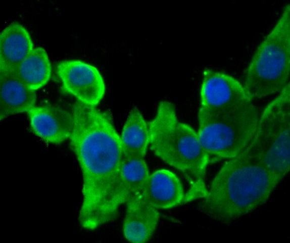 STUB1 Antibody in Immunocytochemistry (ICC/IF)