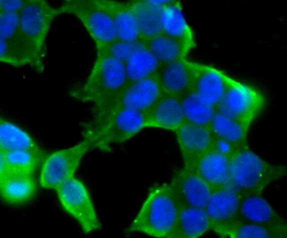 STUB1 Antibody in Immunocytochemistry (ICC/IF)