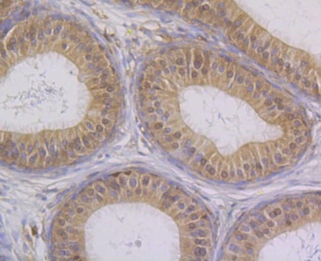 STUB1 Antibody in Immunohistochemistry (Paraffin) (IHC (P))