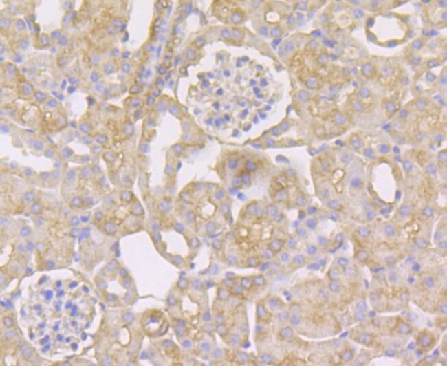 STUB1 Antibody in Immunohistochemistry (Paraffin) (IHC (P))