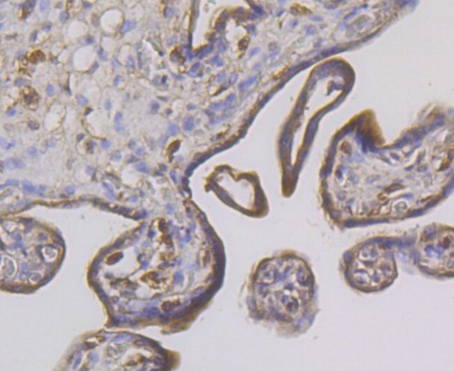 STUB1 Antibody in Immunohistochemistry (Paraffin) (IHC (P))