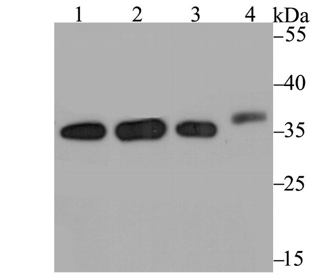 STUB1 Antibody in Western Blot (WB)