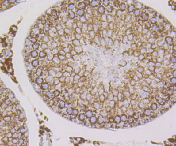 HSPE1 Antibody in Immunohistochemistry (Paraffin) (IHC (P))