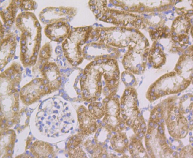 HSPE1 Antibody in Immunohistochemistry (Paraffin) (IHC (P))