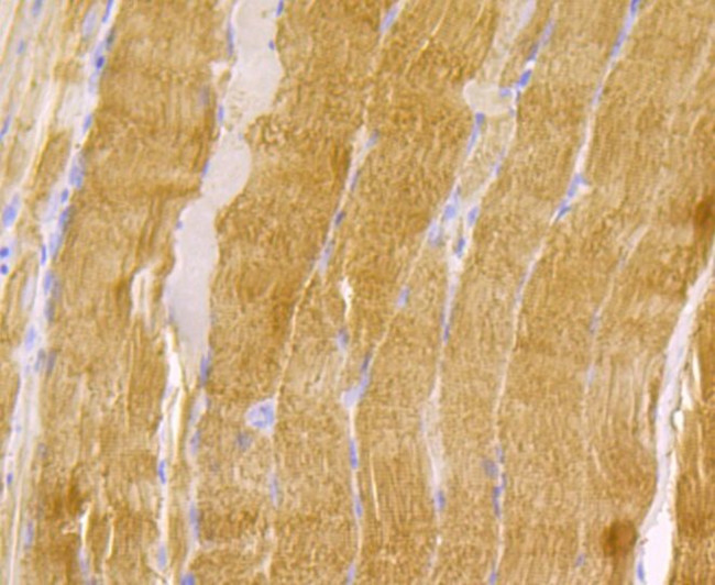 TPM1 Antibody in Immunohistochemistry (Paraffin) (IHC (P))