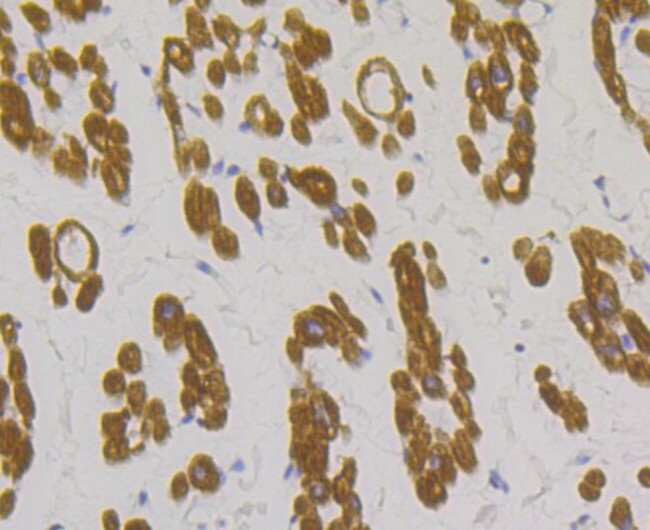 TPM1 Antibody in Immunohistochemistry (Paraffin) (IHC (P))