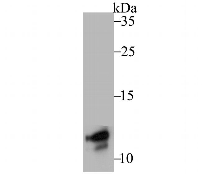 TYROBP Antibody in Western Blot (WB)