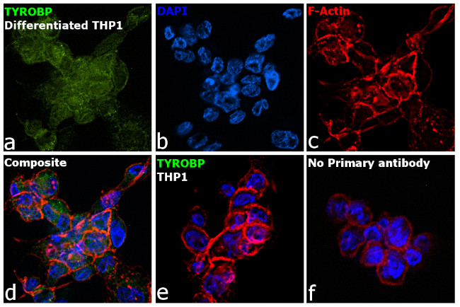 TYROBP Antibody in Immunocytochemistry (ICC/IF)