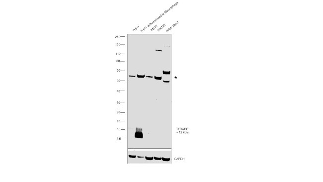 TYROBP Antibody in Western Blot (WB)