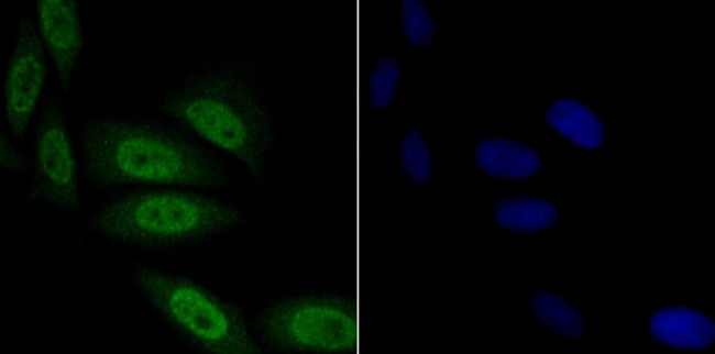 TNPO3 Antibody in Immunocytochemistry (ICC/IF)