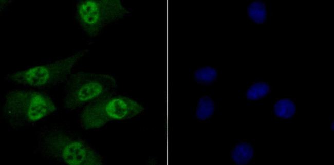 TNPO3 Antibody in Immunocytochemistry (ICC/IF)