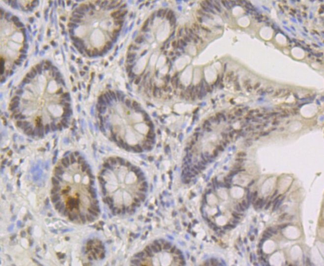 TNPO3 Antibody in Immunohistochemistry (Paraffin) (IHC (P))