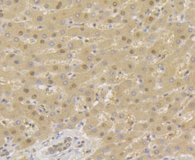 TNPO3 Antibody in Immunohistochemistry (Paraffin) (IHC (P))