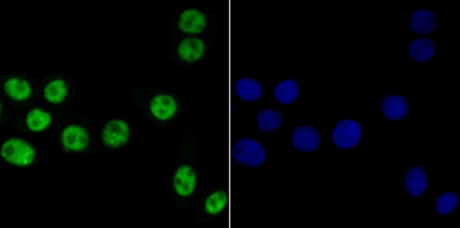 Bub3 Antibody in Immunocytochemistry (ICC/IF)