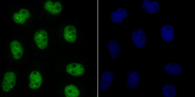 Bub3 Antibody in Immunocytochemistry (ICC/IF)