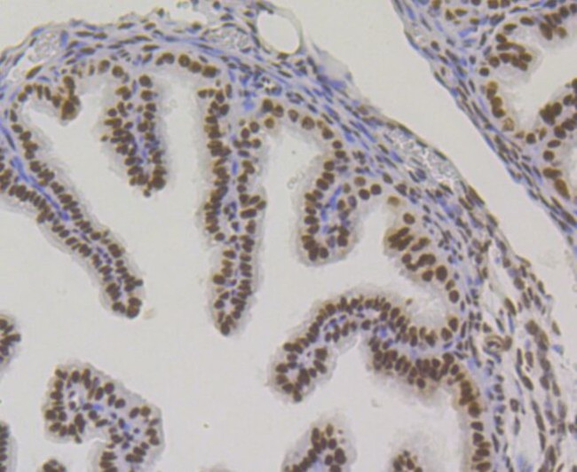 Bub3 Antibody in Immunohistochemistry (Paraffin) (IHC (P))