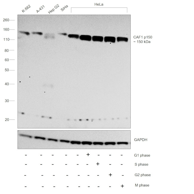 CAF1 p150 Antibody in Western Blot (WB)