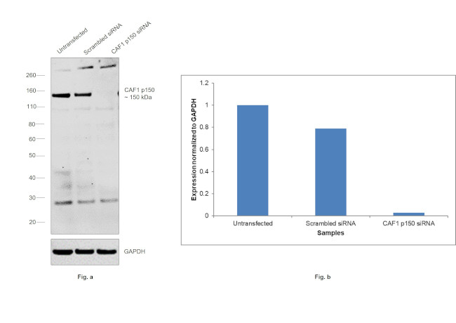 CAF1 p150 Antibody in Western Blot (WB)