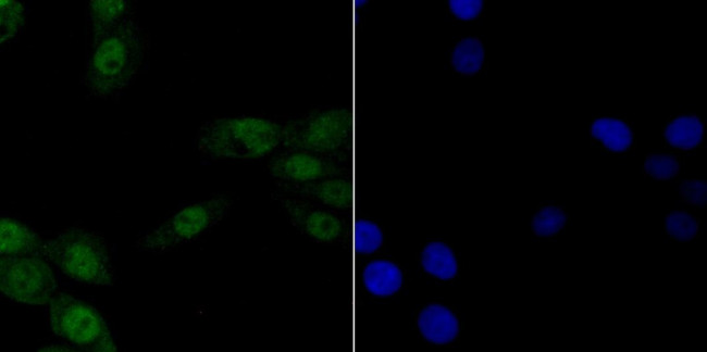 CAF1 p150 Antibody in Immunocytochemistry (ICC/IF)