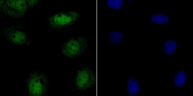 CAF1 p150 Antibody in Immunocytochemistry (ICC/IF)