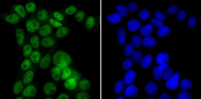 CAF1 p150 Antibody in Immunocytochemistry (ICC/IF)