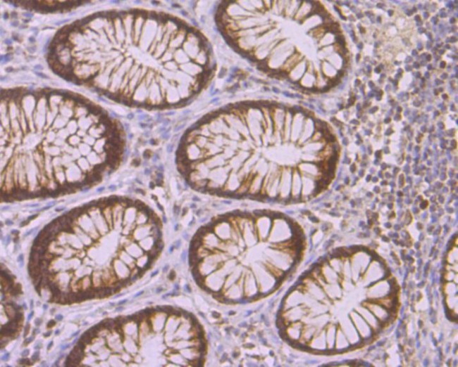 CAF1 p150 Antibody in Immunohistochemistry (Paraffin) (IHC (P))