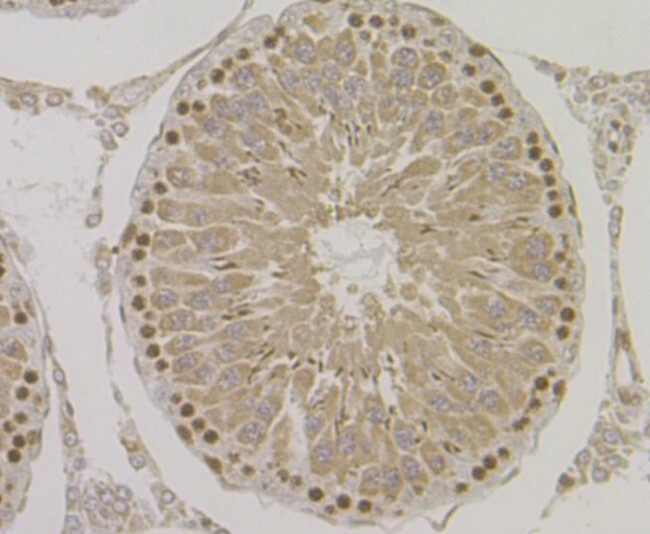 HYOU1 Antibody in Immunohistochemistry (Paraffin) (IHC (P))