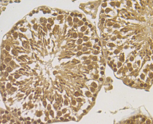 HYOU1 Antibody in Immunohistochemistry (Paraffin) (IHC (P))