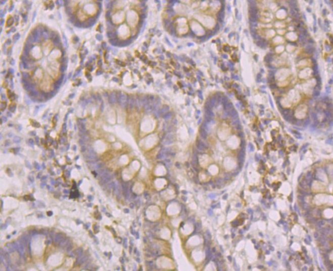 HYOU1 Antibody in Immunohistochemistry (Paraffin) (IHC (P))