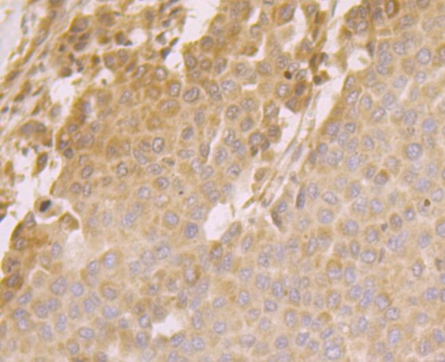 HYOU1 Antibody in Immunohistochemistry (Paraffin) (IHC (P))