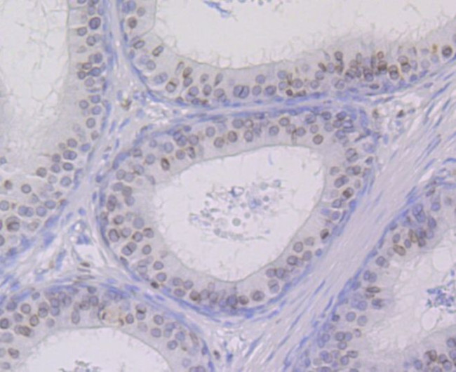 UNC84B Antibody in Immunohistochemistry (Paraffin) (IHC (P))